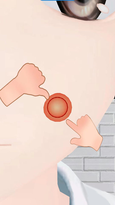 全民大挑战挤痘痘游戏