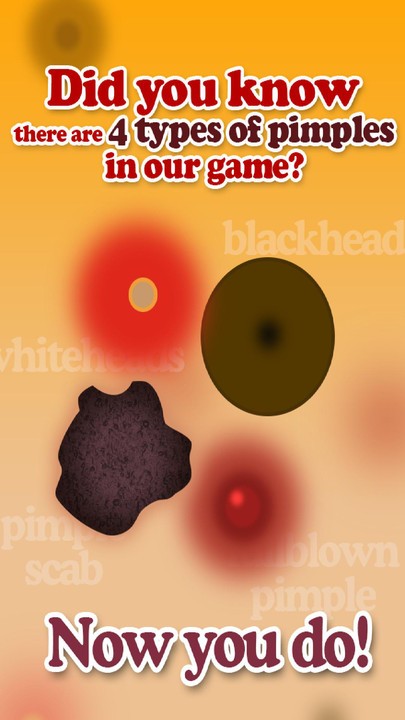 我挤痘痘贼6手机版下载