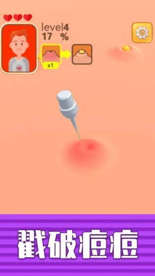 挤痘贼爽小游戏