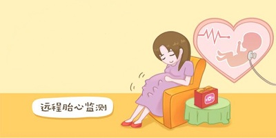 胎心软件