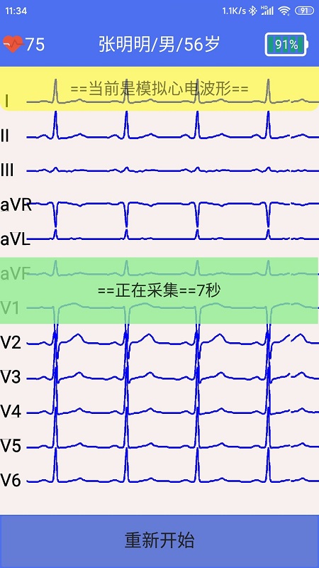 健康2030智能读图心电图系统app