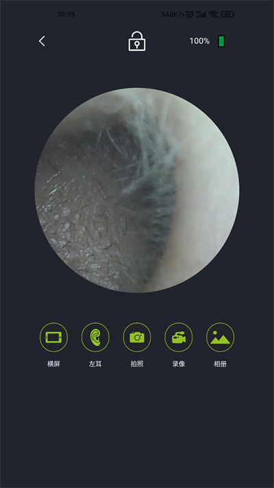 米螺采耳app下载