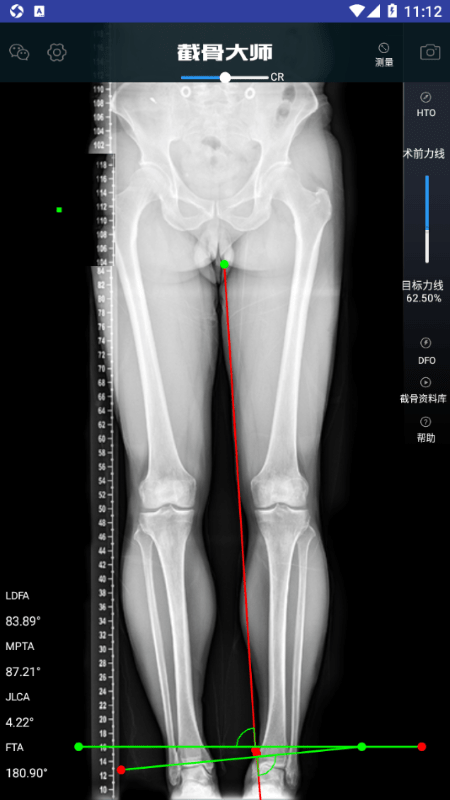 截骨大师app 截骨大师软件下载